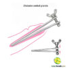 Dilatador uretral grande - Image 3